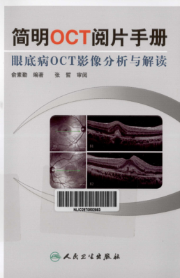 简明OCT阅片手册 眼底病OCT影像分析与解读 俞素勤 主编 2012年版